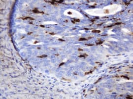 TP / Thymidine Phosphorylase Antibody (aa311-482, clone 7A6, Carrier-free)