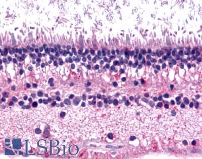 PathPlus™ GRM6 / MGLUR6 Antibody (N-Terminus)