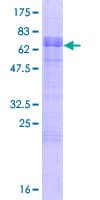 Human LDLRAD3 Protein (Recombinant GST)