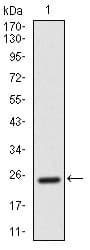 ALCAM / CD166 Antibody (clone 5B3)