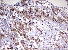 Monoclonal Mouse anti-Human CDCA7L Antibody (clone OTI1A12, aa1-337, IHC, WB)