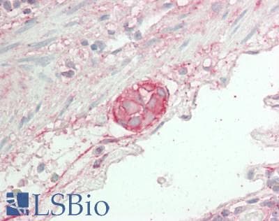 IHC-plus™ Polyclonal Rabbit anti-Human DCLK / DCLK1 Antibody (aa690-740, IHC, WB)
