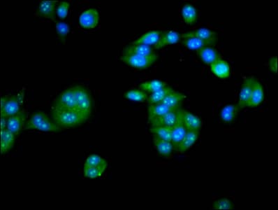 Polyclonal Rabbit anti-Human PKIG Antibody (IF)
