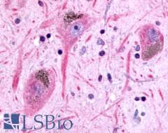 PathPlus™ Polyclonal Rabbit anti-Human GPR45 Antibody (C-Terminus, IHC)