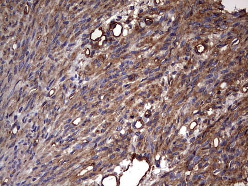 KRT7 / CK7 / Cytokeratin 7 Antibody (clone OTI2A2)