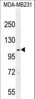 SEMA3G / Semaphorin 3G Antibody (aa216-244)