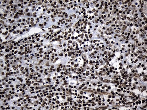 Monoclonal Mouse anti-Human ELF4 / MEF Antibody (clone OTI2D8, aa83-345, IHC, WB)