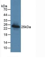 MAC-2-BP / LGALS3BP Antibody (clone C2, Biotin)