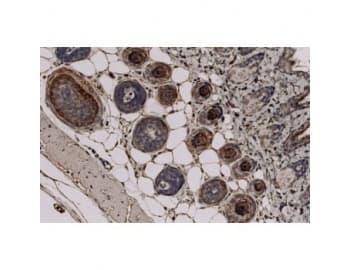 Monoclonal Mouse anti-Human TCHH / Trichohyalin Antibody (clone AE15, IHC, WB)
