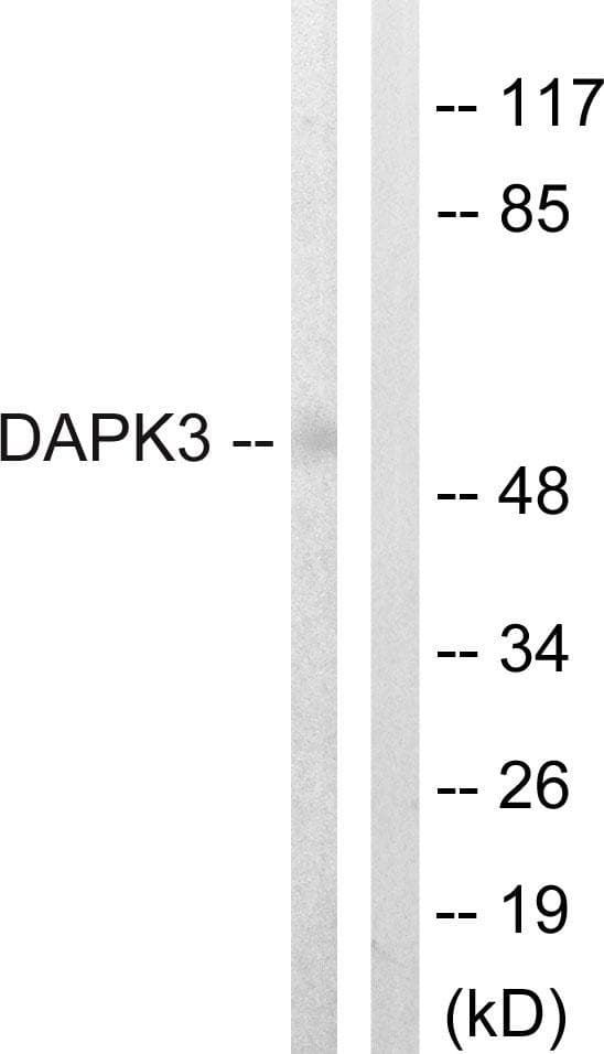 DAPK3 / ZIP Kinase Antibody (p265)