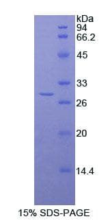 Human TTN / Titin Protein (Recombinant His)