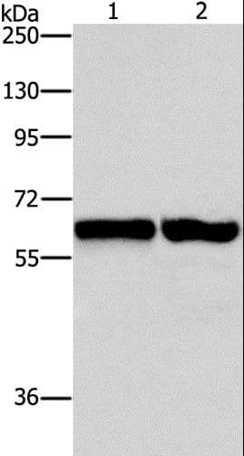 ASNS Antibody