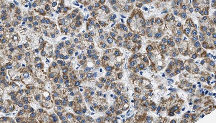 Polyclonal Rabbit anti-Human GRM3 / MGLUR3 Antibody (IHC, WB)