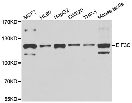 EIF3C / EIF3S8 Antibody