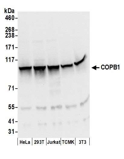 Polyclonal Rabbit anti-Human COPB1 / Beta-COP Antibody (aa903-853, WB)