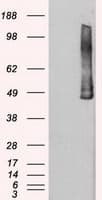 PLK1 / PLK-1 Antibody (clone OTI1D4)