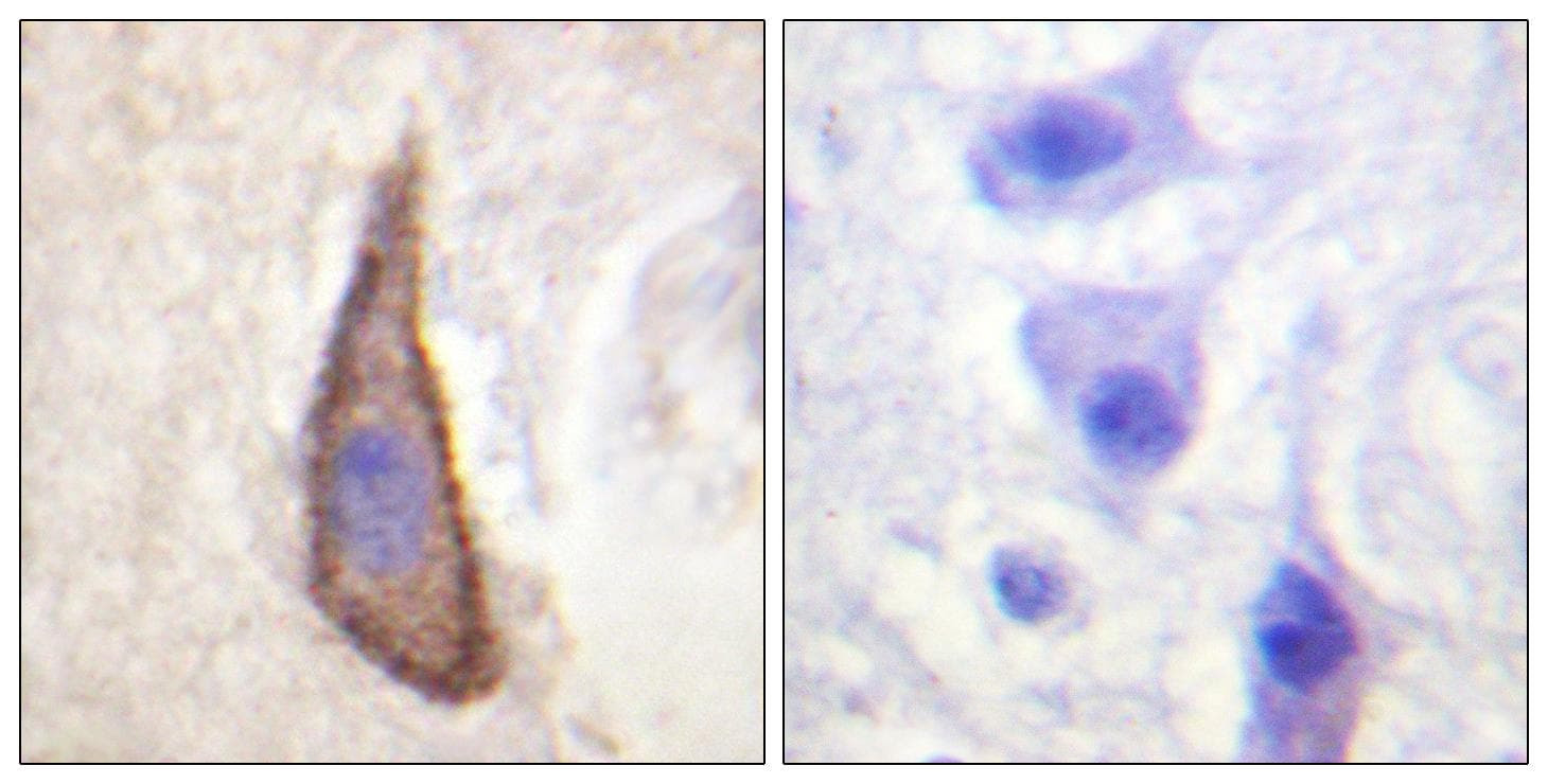 DNAM-1 / CD226 Antibody (phospho-Ser329)