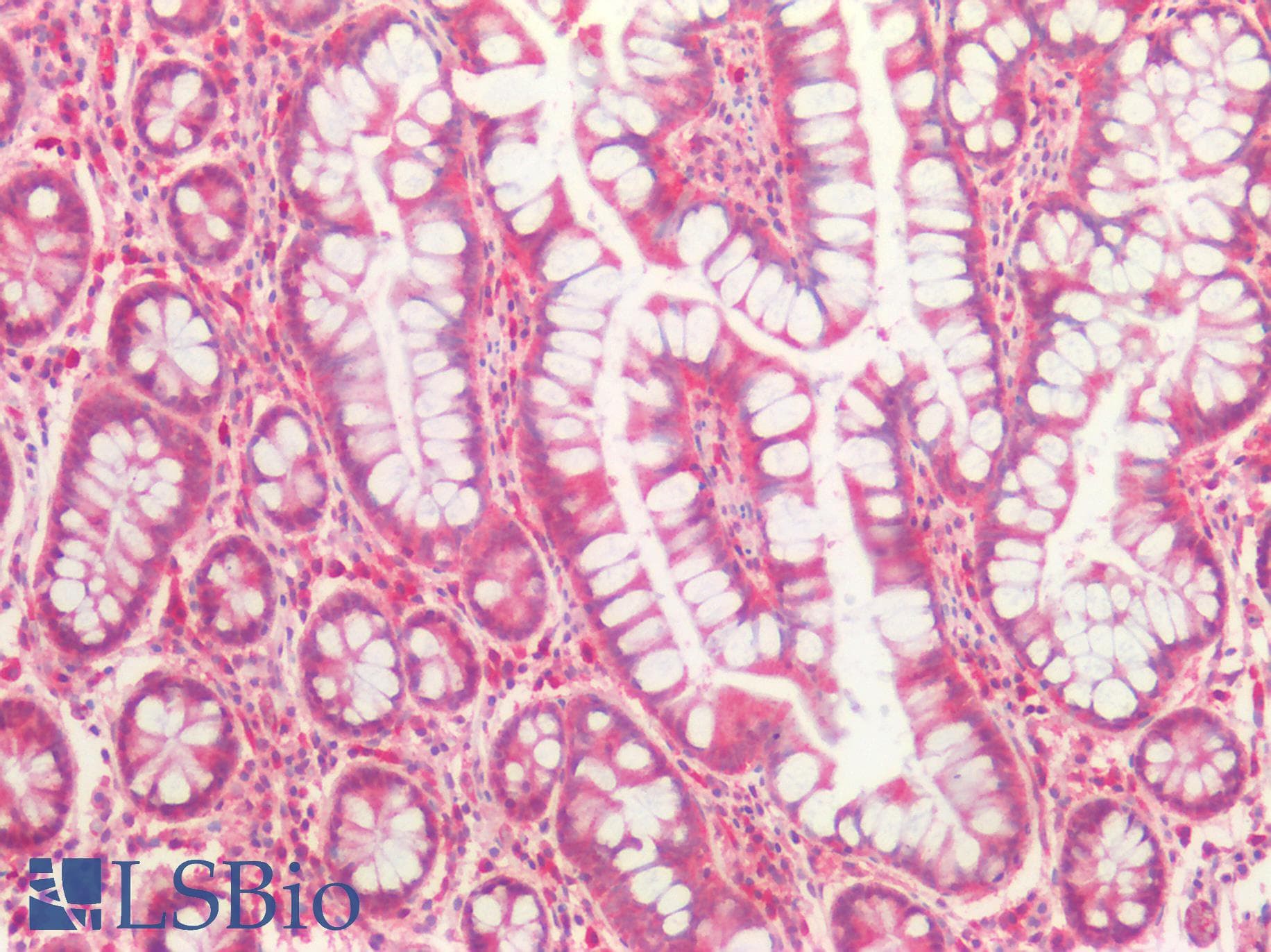 PathPlus™ CASP10 / Caspase 10 Antibody