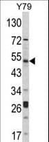 AKT1 Antibody (aa438-468)