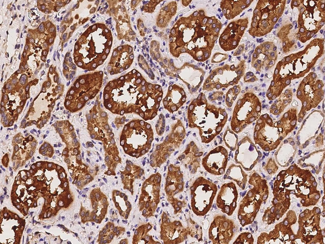 HDAC6 Antibody