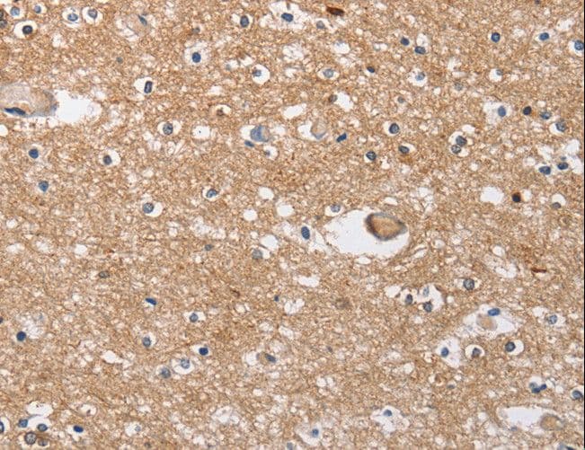 SOCS2 Antibody