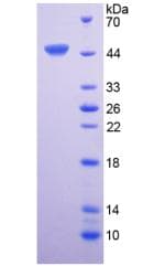 Human IL6 / Interleukin 6 Protein (Recombinant His-GST, N-terminus)