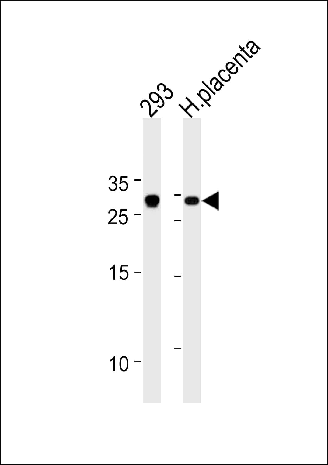 TCF21 / Epicardin Antibody (aa144-173)