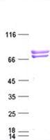 Human CEACAM5 / CD66e Protein (Recombinant DDK,C-terminus)