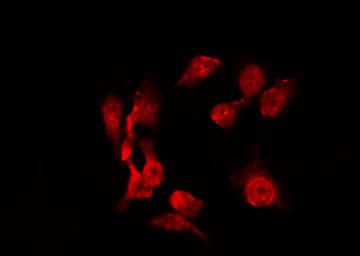 Polyclonal Rabbit anti-Human AURKA / Aurora-A Antibody (phospho-Thr288, IHC, IF, WB)