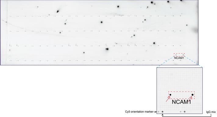 NCAM / CD56 Antibody (aa20-718, clone UMAB83, Carrier-free)