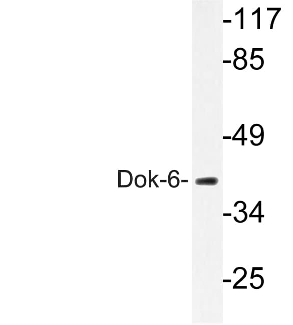 DOK6 Antibody (Gly130)