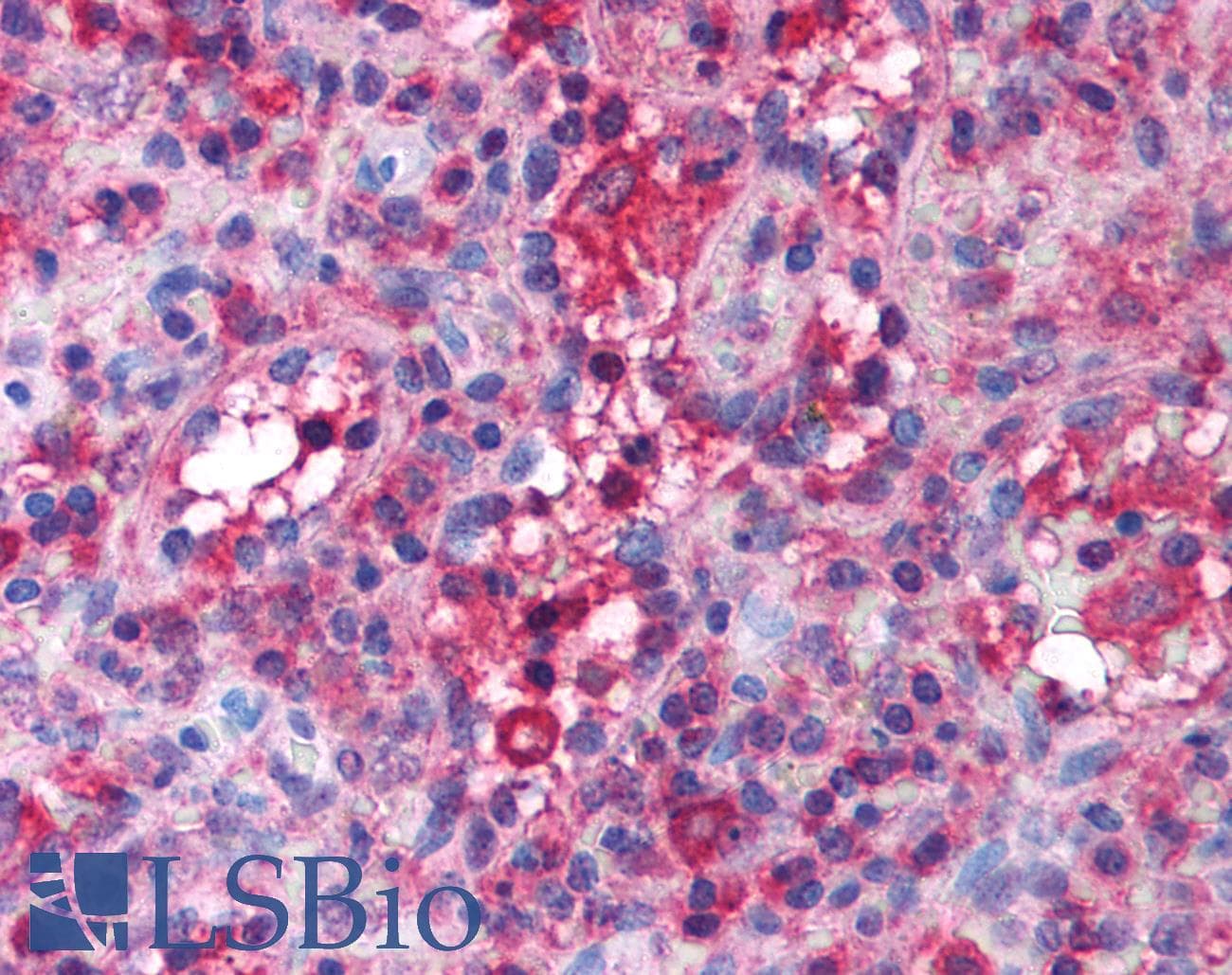 SLC4A1 / Band 3 / AE1 Antibody (aa184-233)
