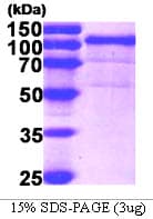 Human HSP90B1 / GP96 / GRP94 Protein (Recombinant His)