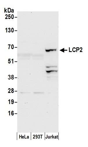 LCP2 / SLP-76 Antibody (aa200-250)