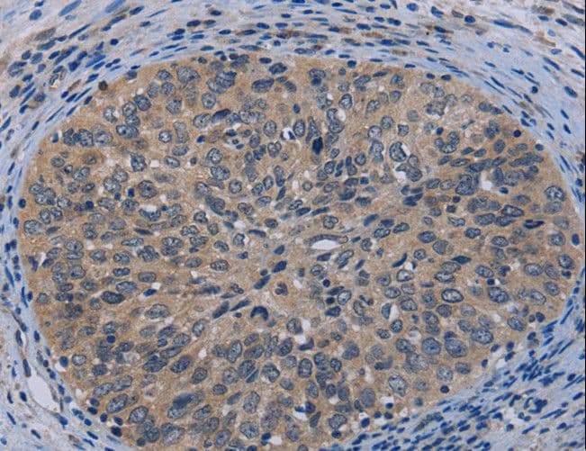 TP53AIP1 / p53 AIP1 Antibody