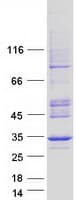 Human ANT2 / SLC25A5 Protein (Recombinant Myc-DDK (Flag))