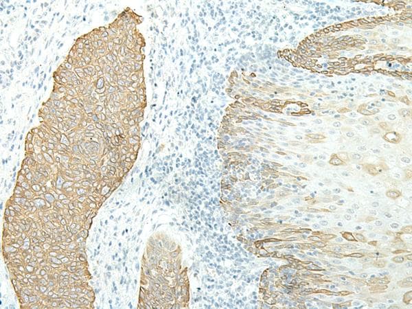 ETAA1 Antibody
