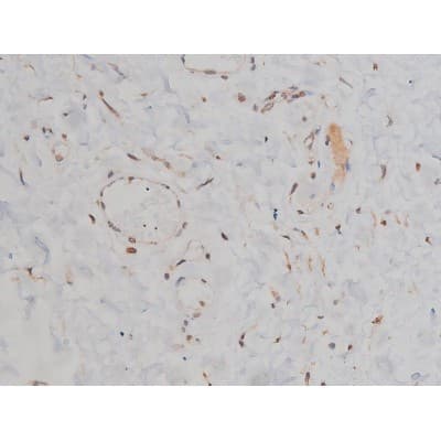 SYN / FYN Antibody (phospho-Tyr530)