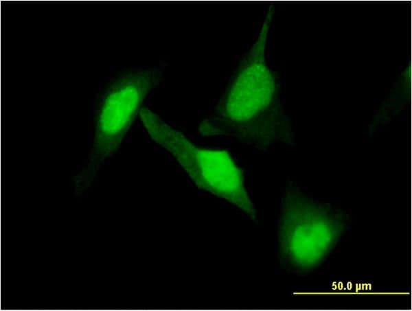 Monoclonal Mouse anti-Human DPYSL2 / CRMP2 Antibody (clone 1F11, IF, WB)