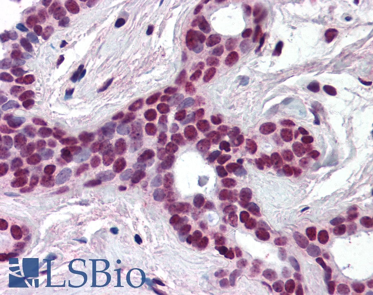IHC-plus™ CUL3 / Cullin 3 Antibody (aa1-25)