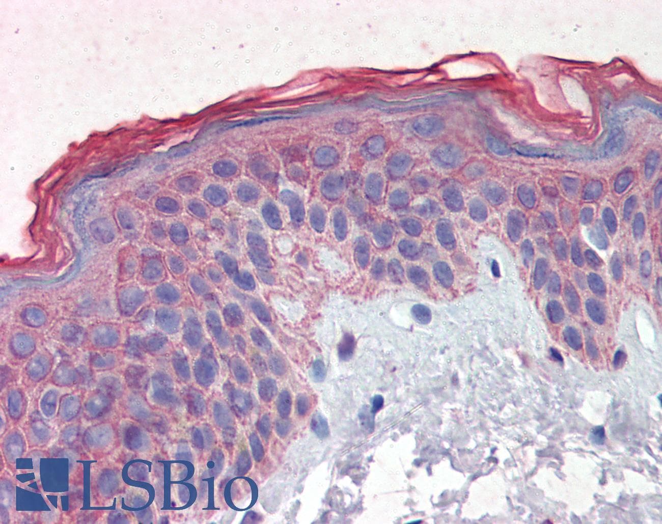 IHC-plus™ EPHB2 / EPH Receptor B2 Antibody (aa17-200, clone 2D12C6)