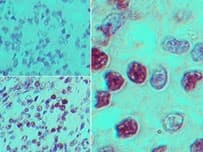 Polyclonal Rabbit anti-Human GPR183 / EBI2 Antibody (aa300-350, IHC, WB)