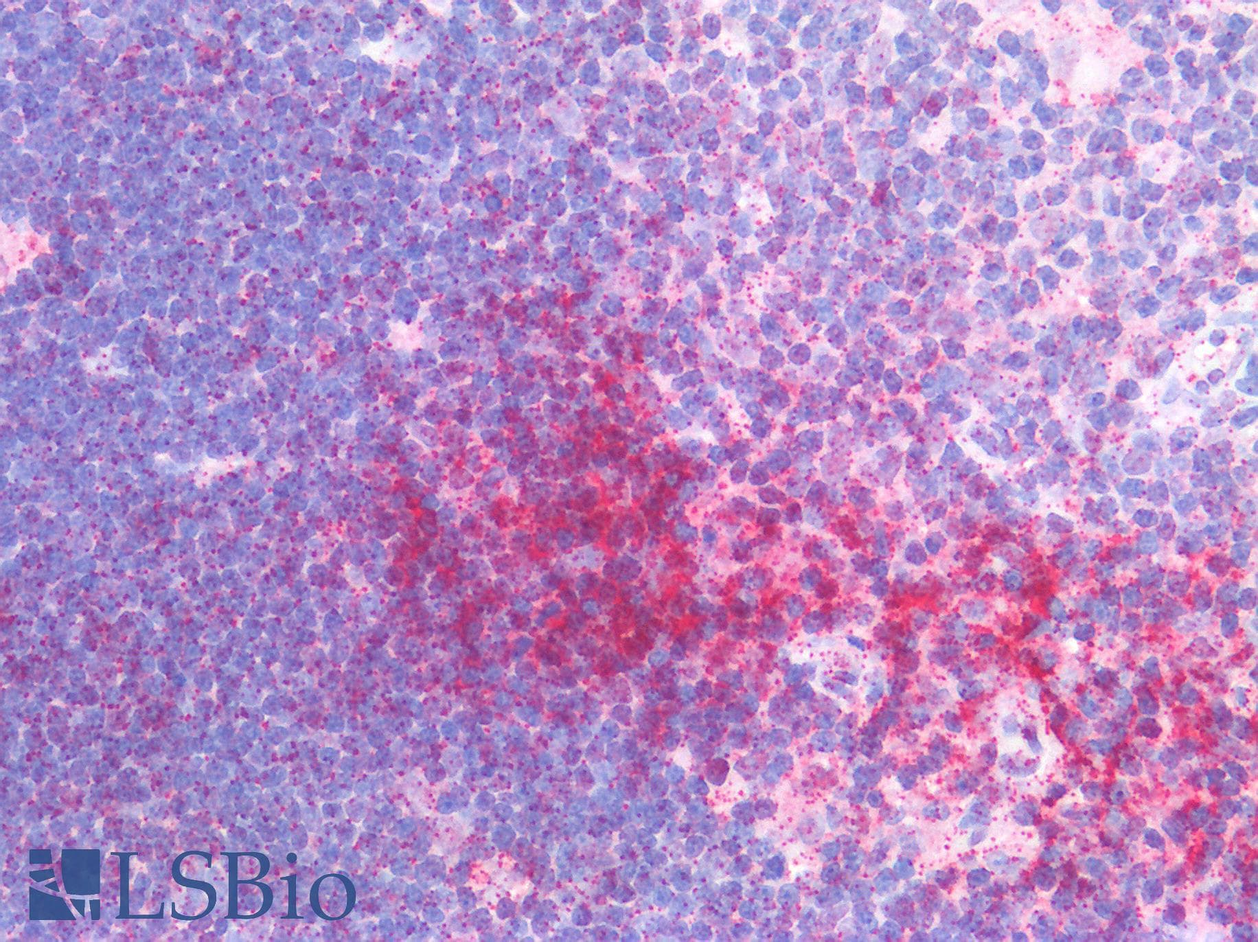 PathPlus™ IL17A Antibody