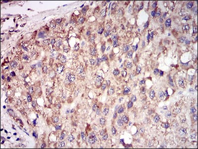 ACP5 / TRAP Antibody (aa221-325, clone 7E6A11)