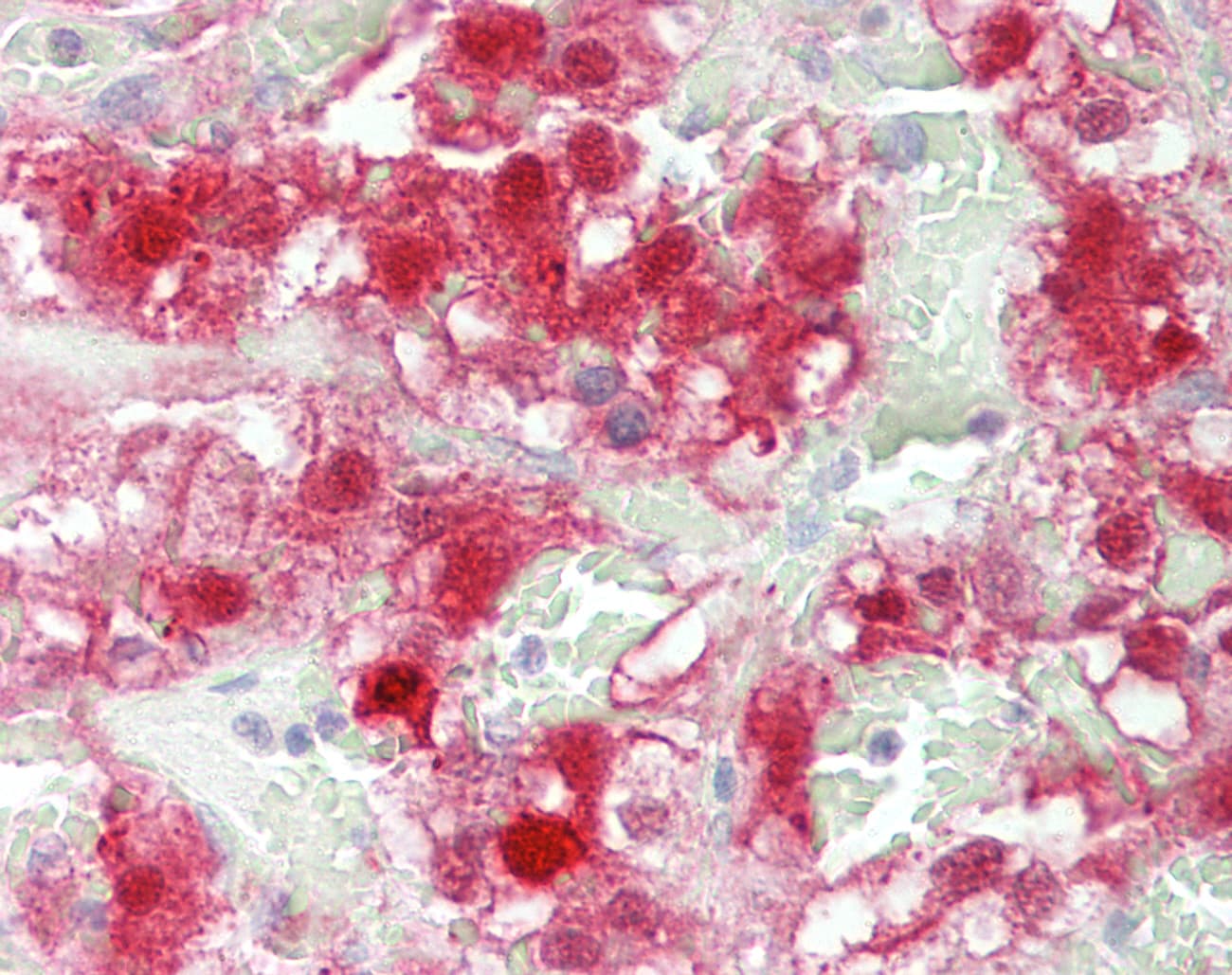 IHC-plus™ GDPD5 Antibody