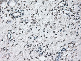 BRAF / B-Raf Antibody (clone OTI1G8)