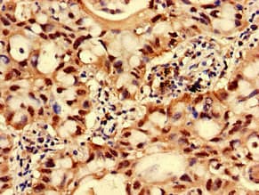 Gpnat1 / GNPNAT1 Antibody