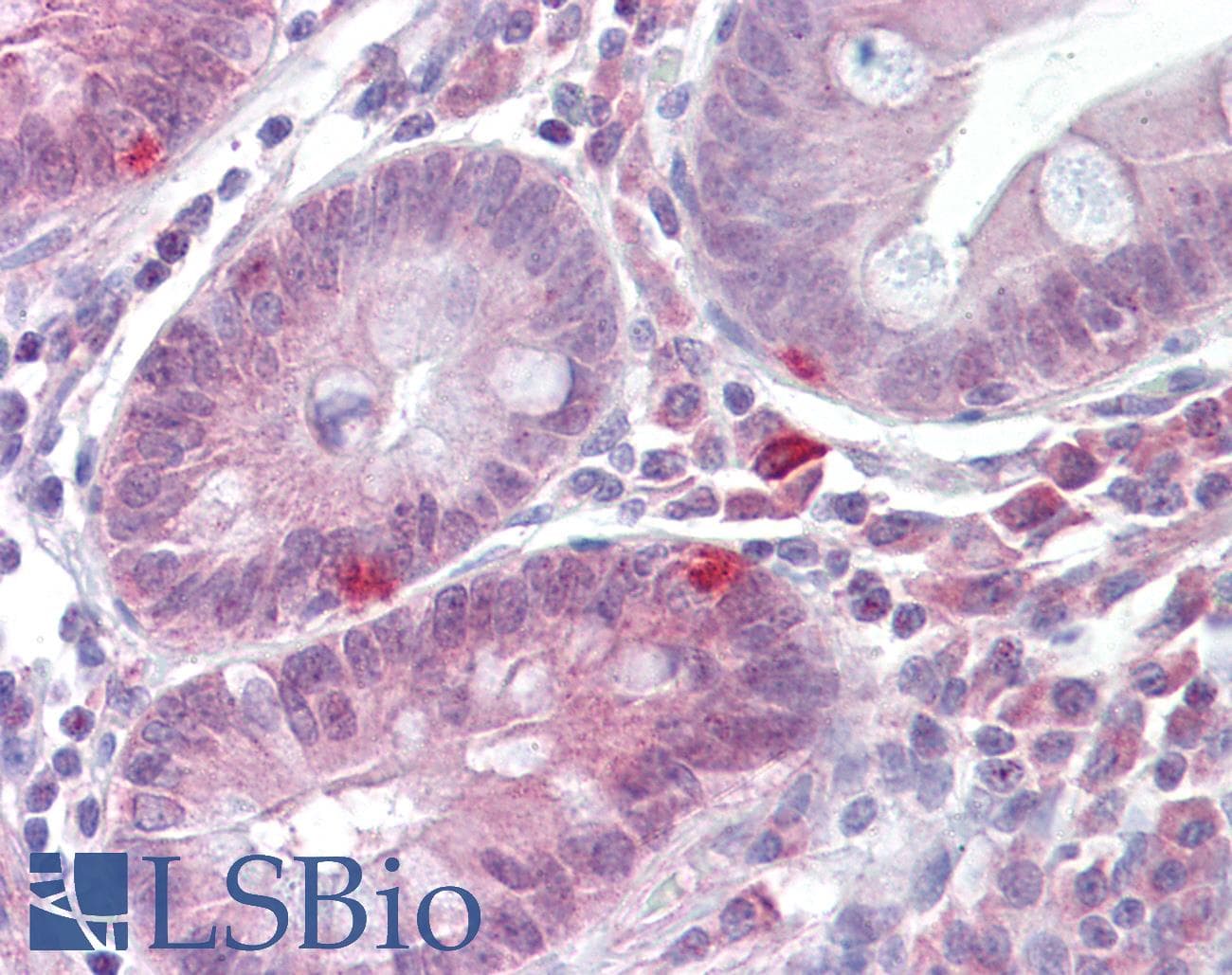 IHC-plus™ Polyclonal Rabbit anti-Human ZBTB7A / Pokemon Antibody (IHC, IF, WB)