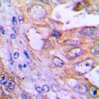 TOPBP1 Antibody