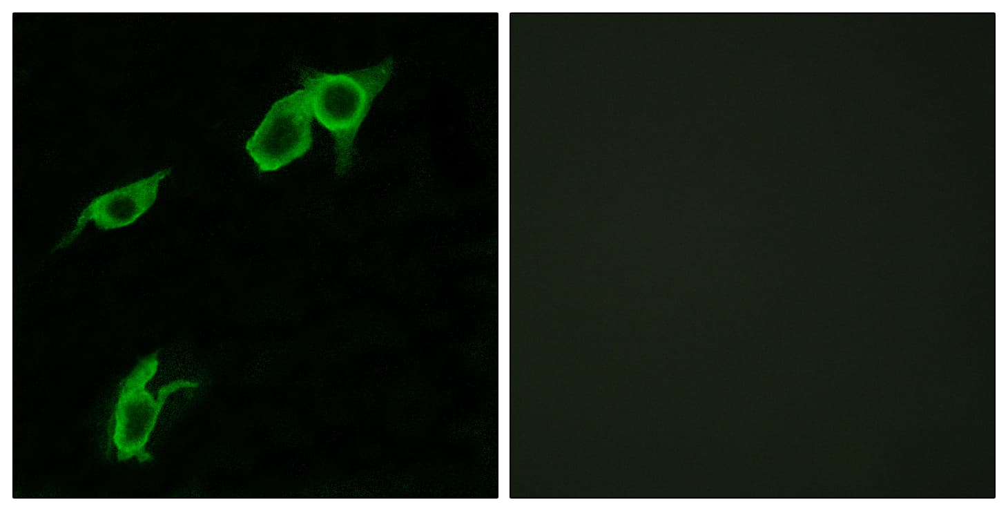 GPR75 Antibody (aa381-430)